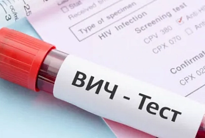 На Гомельщине за январь-март заболеваемость ВИЧ увеличилась на 30%